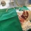 국내서 가장 작은 '260ｇ' 아기, 198일 만에 엄마랑 집으로