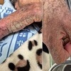 요양센터서 옴 방치된 90대 사망…소극대응 논란